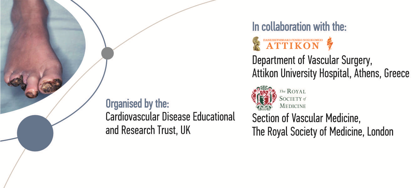 New developments and controversies in the multidisciplinary management of the diabetic foot, Athens 26 May 2017