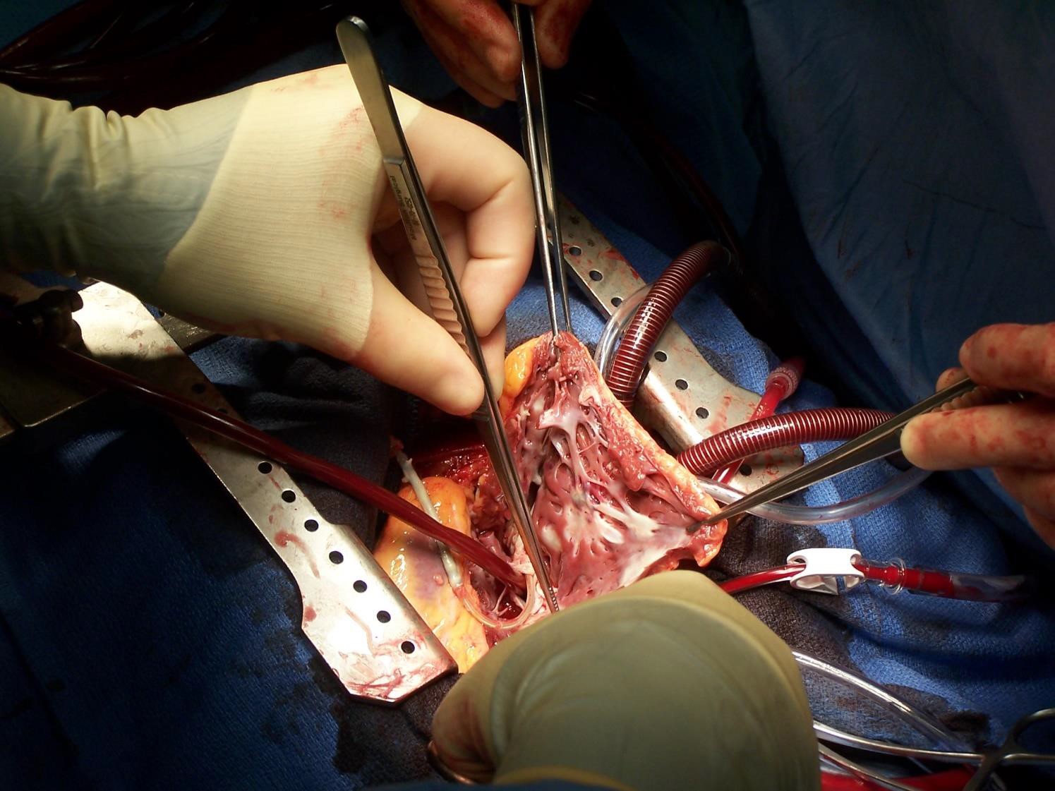 Πρόγραμμα με τίτλο «Cardiac Surgery Training Vascular Anastomosis Certificate Programme», το οποίο αφορά στην ειδικότητα Καρδιοχειρουργικής – Καρδιολογίας.