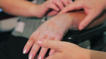 Εκδήλωση για την παγκόσμια ημέρα οστεοπόρωσης, Πάτρα 25/10/2021, 6.30 μμ