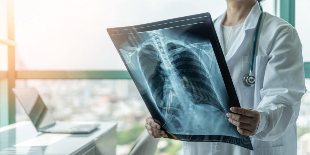 Θέσεις εργασίας ιατρών Ακτινολόγων στη Ζάκυνθο